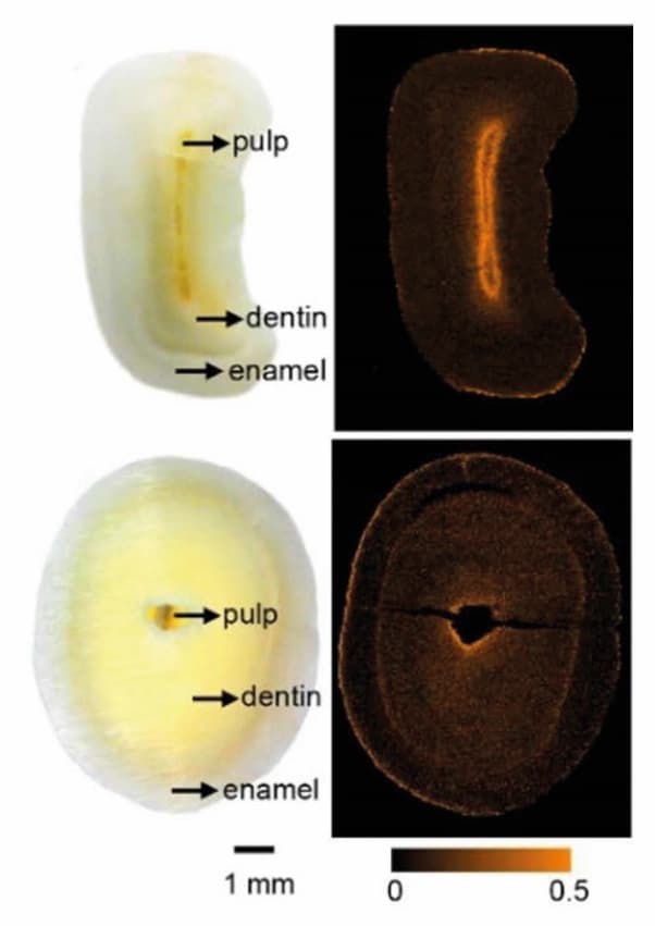 Fluor-Imaging mit Massenspektrometrie