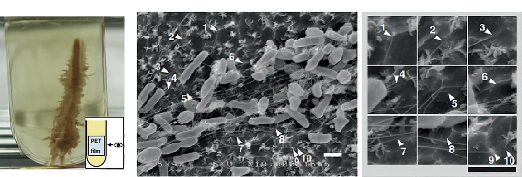 Biologie gegen Plastikmüll